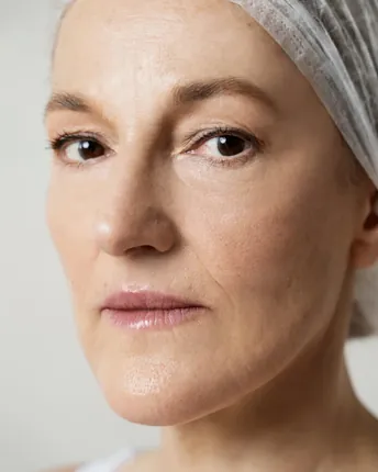 Smooth, refreshed skin after a med spa treatment.